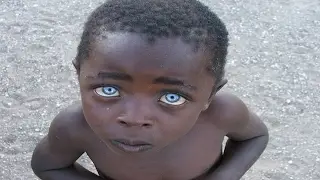 Top 5 World's Rare and Awesome Eyes