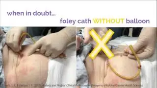 Feeding tube replacements