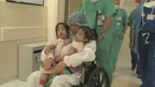 RISKY SURGERY: Doctors at Stanford separate conjoined twins