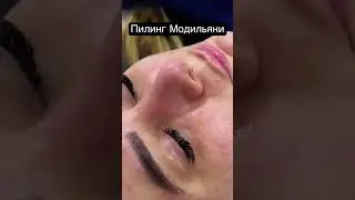Пилинг Модильяни