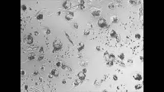 Macrophages  sweep up and ingest PODS cytokine co-crystal nanoparticles