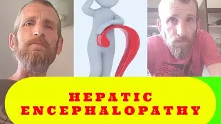 Hepatic Encephalopathy Strikes Back - Liver Cirrhosis Vlog