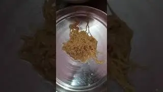 || maggi me ye kya  ? सावधान आप भी maggi khate hai to ek bar jarur dekhe