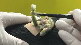 Treatment Of Blackhead Removal at Lam Dep Spa #036