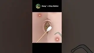 Get rid of the stinky belly button! Belly Button Cleaning Animation