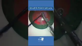 PHACO Soft Lens Training Demonstration