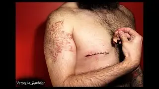 Модификация тела. Удаление соска и молочной железы. Nipple removal 18+