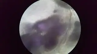 Focusing in on a Potato
