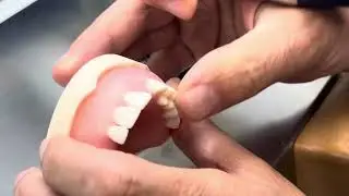 How to create Pontic Space on edentulous area