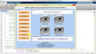 Iris Recognition Using Image Processing Matlab Project Code