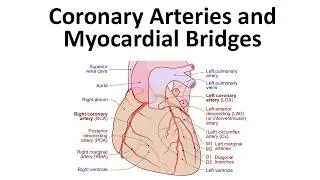 Coronary Arteries and Myocardial Bridges
