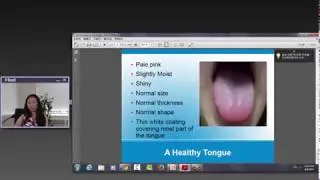 Traditional Chinese Medicine Webinar: Tongue Diagnosis