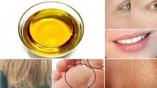 5 Effective Castor Oil Remedies for Hair, Skin, and Health