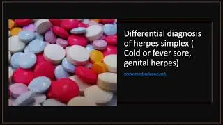 Medical Zone-Differential diagnosis of herpes simplex  Cold or fever sore, genital herpes