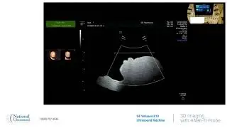 GE Voluson E10 3D Imaging Training Video Demonstration
