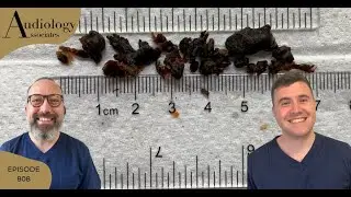 TEENAGERS 7CM EAR WAX REMOVAL - EP808