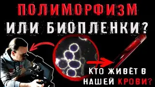 Полиморфизм или биопленки: кто живет в  нашей крови?