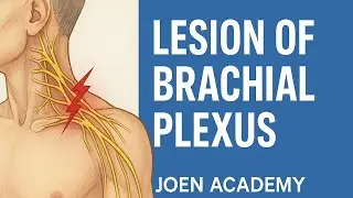 Lesions and Diagnosis of the Brachial Plexus Injuries
