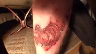 The aftermath of 