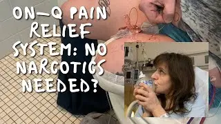 On-Q Pain Relief System Review and Removal after Above Knee Amputation Revision Surgery