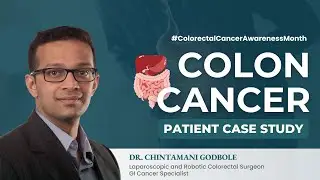 Colon Cancer Case Study: Timely Detection & Successful Treatment | Dr. Chintamani Godbole