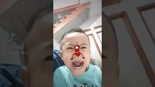 Hidung ikut joged #shorts