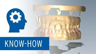 Ceramill Mind - New design for scan software Ceramill Map400