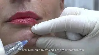 סדנת תיאוסיאל 2019 - פיסול סנטר עם קנולה ומזרק אוטומטי