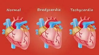 Diagnosticul și tratamentul aritmiilor☝