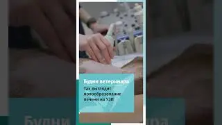 новообразование печени