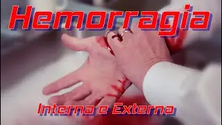Hemorragia tipo 1