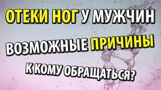 Почему отекают ноги у мужчин. К кому обращаться чтобы выяснить причину.