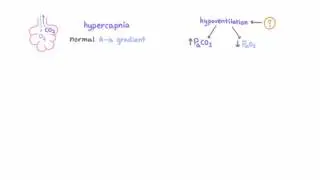 Hypoventilation