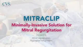The MitraClip: A Minimally-Invasive Solution for Mitral Regurgitation