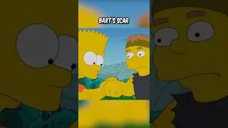 Bart's scar
