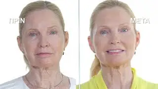 Helix Dermaspray