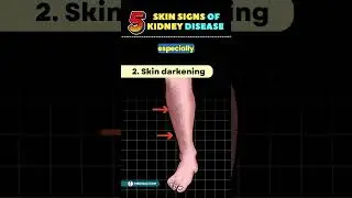 5 Weird Skin Signs of Kidney Disease | Chronic Kidney Disease 