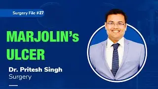 Topic | MARJOLIN's ULCER I Dr. Pritesh SIngh | Surgery