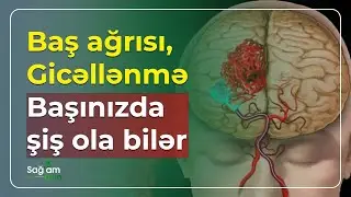 Beyin şişlərinin əlamətləri nələrdir və diaqnozu necə qoyulur? - Sağlam Olun (21.06.2023)