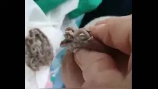 A ESPINHA MAIS NOJENTA QUE VOCÊ JÁ VIU! 🤢🤮 - Vídeos Satisfatórios