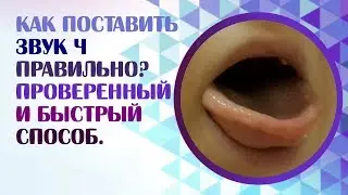 Как поставить звук Ч правильно? Проверенный и быстрый способ при дизартрии