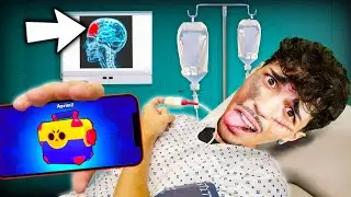 MI SONO FATTO MALE E NON POSSO PIÙ GIOCARE A BRAWL STARS?!💀