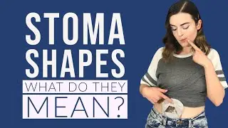 Decoding Stoma Shapes