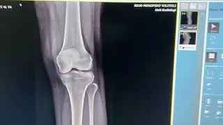 Seting DR Toshiba agar bisa mengirimkan gambar dicom ke pacs orthanc