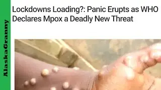 Prepping Monkeypox Next Pandemic How To Prepare