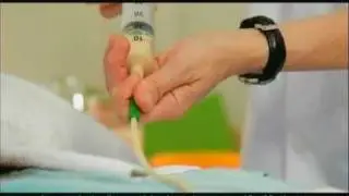 9 - Alimentación por sonda nasogástrica