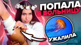 Попала в больницу из - за медузы Катя Голышева