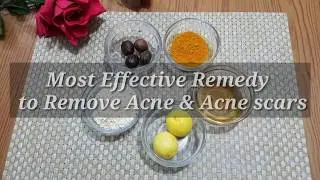 Jaiphal for acne scars, Most Effective Remedy to Remove Acne & Acne scars