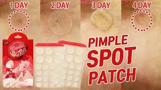 how to use spot patch / spot dots patch 2020