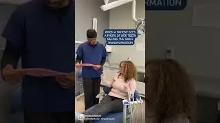 Smile Makeover Before/After reaction